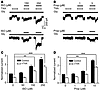 Isoflurane and propofol attenuate TXA inhibition of current evoked by a low