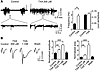 TXA enhances SLEs and evoked field potentials in cortical slices.