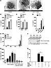 Mechanisms of CaOx crystal–induced IL-1β secretion.