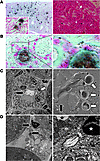 CaOx nephropathy in C57BL/6 mice.