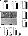 Oxalate nephropathy in C57BL/6 mice.