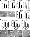 Apyrase and anakinra treatment in CaOx nephropathy in C57BL/6 mice.