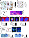 Tumorigenic anomalies in Mob1a/1b double-homozygous mutant keratinocytes.