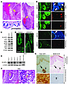 Characterization of skin cancers of Mob1-deficient mice and human trichilem