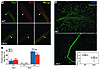 Atrx cKO muscle has normal numbers of satellite cells, yet is unable to eff