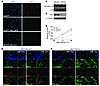 De novo deletion of Atrx reduces the expansion rate of myoblasts, but does