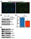 ATRX knockdown in human primary myoblasts leads to p53 induction and reduce