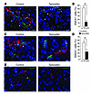 Ablation of Id disrupts adhesion of GICs to endothelial cells in the periva