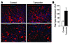 Expression of mesenchymal markers and Rap1gap mRNA in HGG arising in mice i