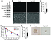 Expression of Rap1GAP impacts human GIC properties.