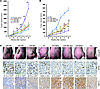 Effect of stably transfected miR-664, miR-485, and miR-495 and their siRNAs