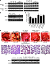 MAT1A is the key mediator of miR-664, miR-485, and miR-495 on tumor growth