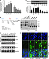 Possible mechanism of miR-664, miR-485-3p, miR-495, and MAT1A involvement i