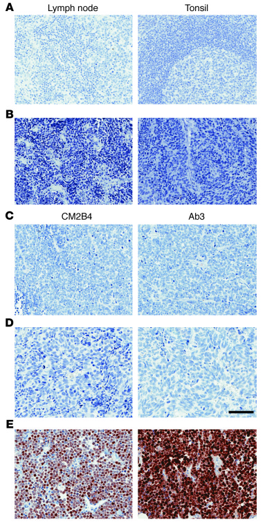 Negative staining with Ab3 of normal lymph node and tonsil and GI neuroe...