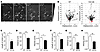 Mutant htt expression in microglia diminishes the extension of microglial p