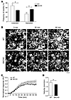 Microglia show defective basal process dynamics and delayed responses to fo