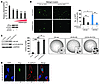 Slug is necessary and sufficient for cyclin D1b–mediated prometastatic and