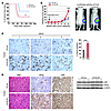 Slug enhances growth of AR-positive PCa cells.