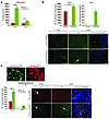 Slug enhances prometastatic phenotypes of PCa cells in vivo.