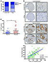 The cyclin D1b–Slug network is conserved in advanced cancers.