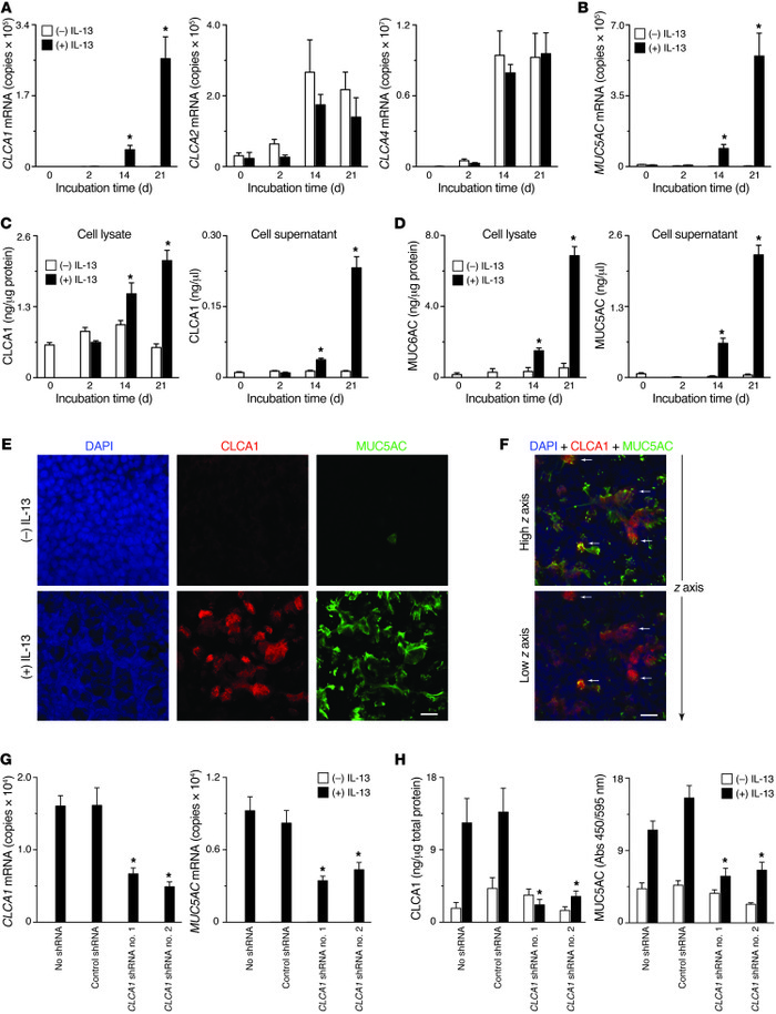 CLCA1 is necessary for IL-13–stimulated mucus production in human airway...