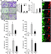 HIF and PGF expressed by BCCs are required for MSC migration and homing.