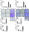 CXCL10 enhances BCC migration and invasion.