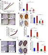 Effect of MSC coculture on metastasis is lost when HIF or CXCR3 expression