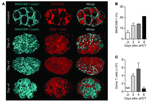 Visualizing and quantifying cellular changes after allo-HCT in 3D.
Bone ...