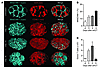 Visualizing and quantifying cellular changes after allo-HCT in 3D.