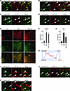 Defects in actin regulation and endocytosis in pod-Dnm-DKO, Synj1 KO, and e