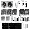 The REEP1 knockout phenotype is progressive, dose-dependent, and associated