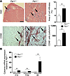 Inflammation in the hearts of CVB3-infected Par1+/+ and Par1–/– mice.