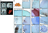 Intracerebroventricular administration of AAV9 vectors to dogs.