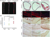 SMC-specific expression of KLF15 suppresses atherosclerosis.