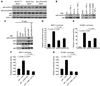 KLF15 suppresses NF-κB transactivation activity in VSMCs.