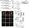 Knockdown of KLF4 in podocytes exacerbates proteinuria in ADM nephropathy.