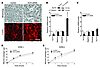 Knockdown of KLF4 expression caused an increase in albumin permeability in