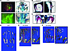 DN-GNAS expression in the somites causes skeletal abnormalities.