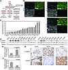 Spheroids from primary ovarian cancer cell lines display differential clear