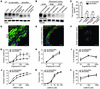 TMEM16A is expressed in the aorta and modulates its contractility but absen