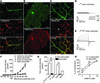 TMEM16A is expressed in small arterioles of brain and retina and enhances c