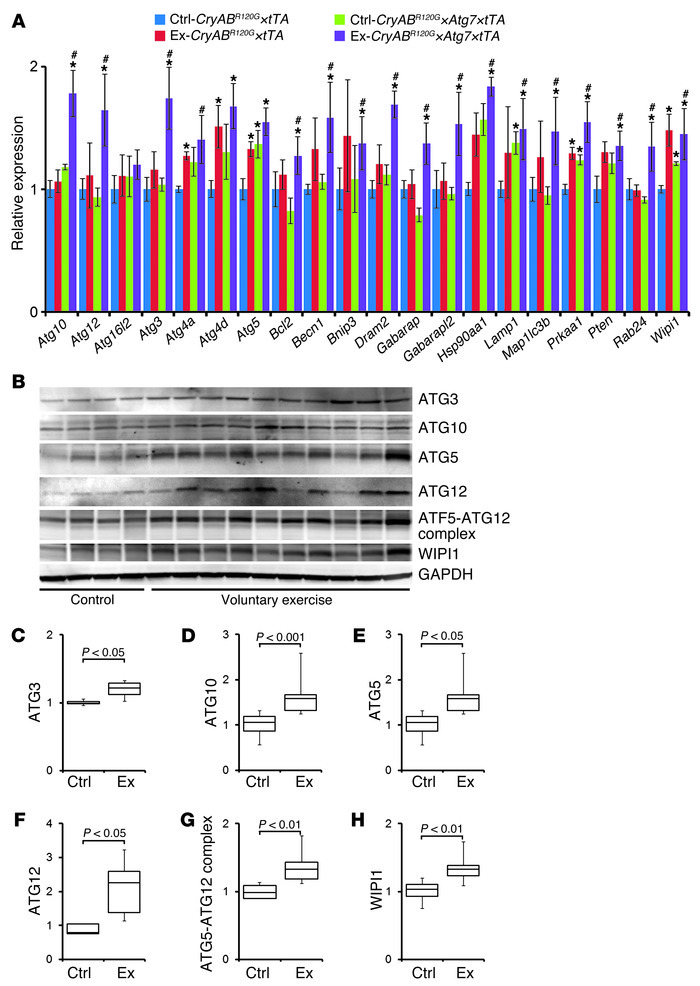 Autophagy response in exercised CryABR120G×Atg7×tTA mouse hearts.
 
(A) ...