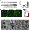 Autophagy in Atg7×tTA mouse hearts.