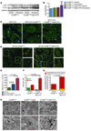 Autophagy flux analysis in CryABR120G×Atg7×tTA mouse hearts.