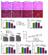 Histology and morphometry of CryABR120G×Atg7×tTA mouse hearts.