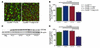 Overexpression of Atg7 significantly reduced misfolded protein accumulation