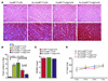 Histology and morphometry of exercised CryABR120G×Atg7×tTA mouse hearts.