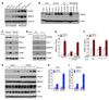 FOXM1 regulates TGF-β/SMAD3-induced transcriptional activity and gene expre