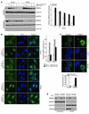 FOXM1 increases nuclear retention of SMAD3.